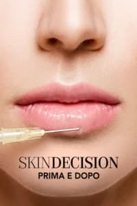 Skin decision: prima e dopo
