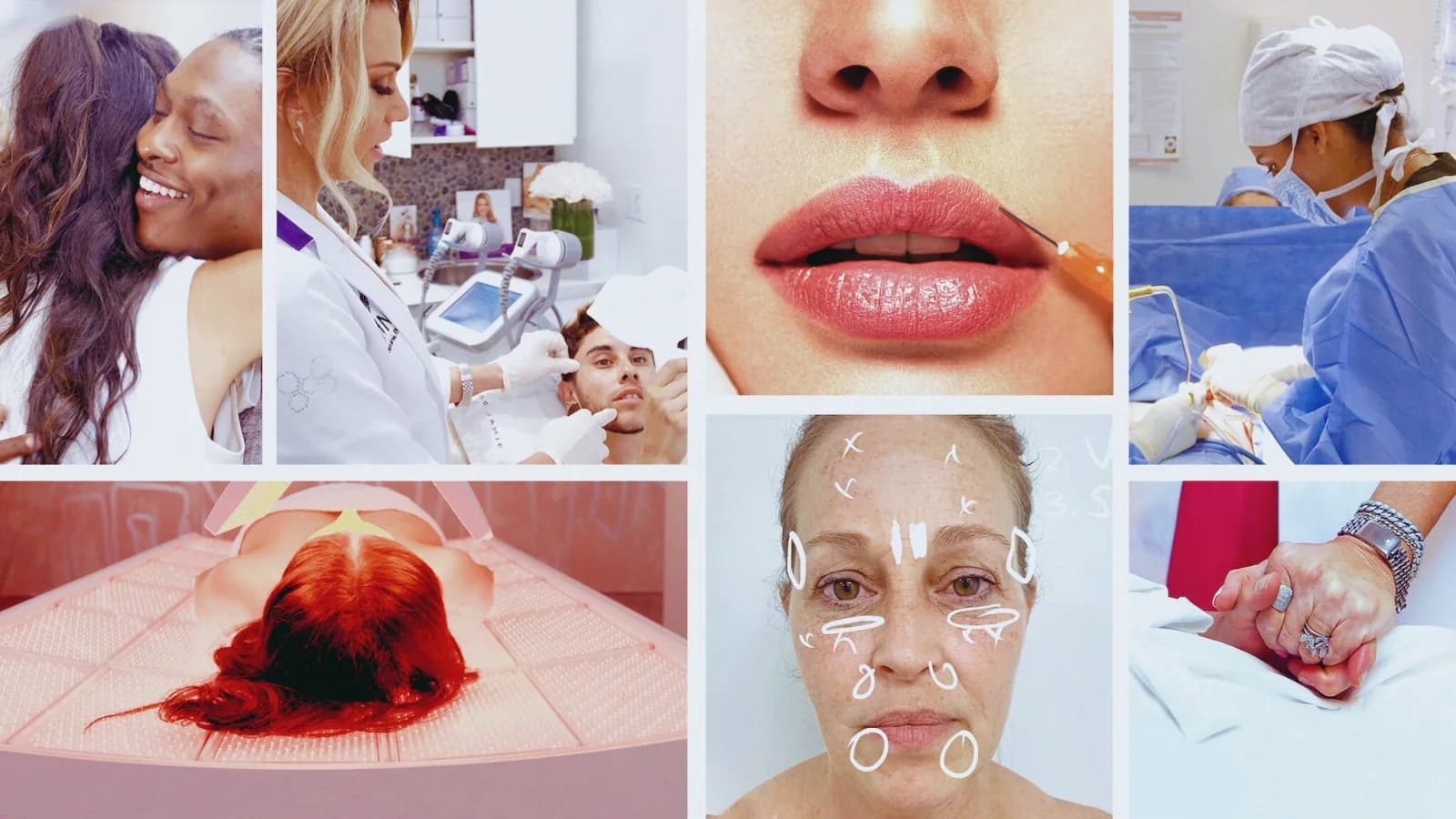 Skin decision: prima e dopo
